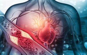 proteina_C_reactiva_riesgo_cardiovascular