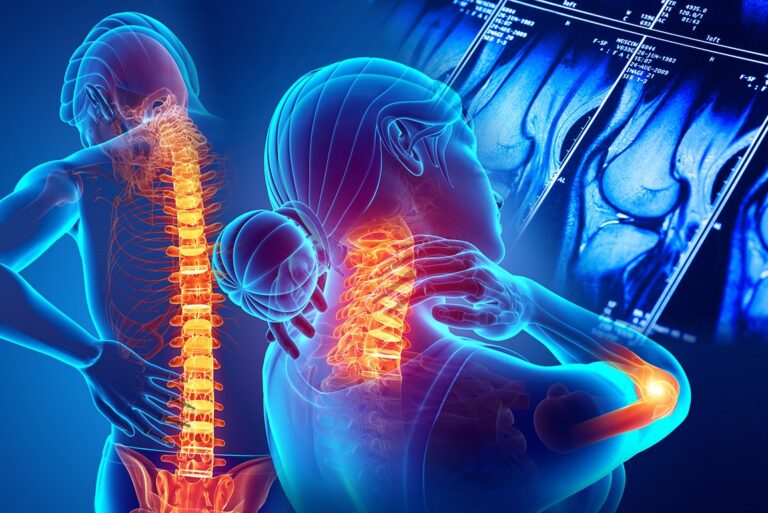 artritis reumatoide y ácidos grasos