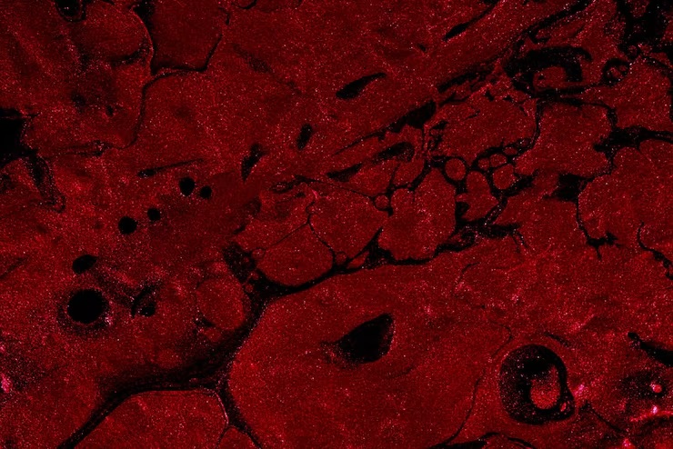 sangre seca Dried Blood Spot por sus siglas en inglés