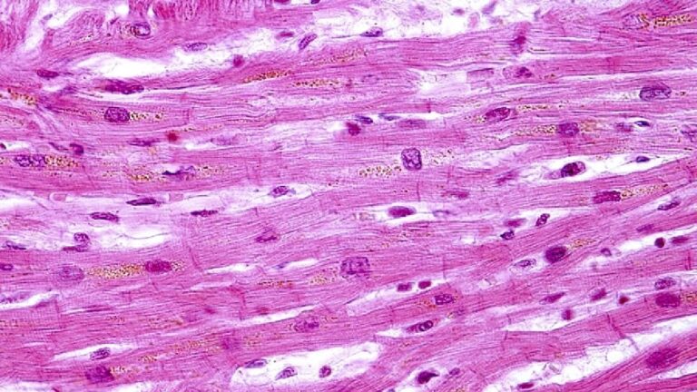 El Músculo Esquelético: Tu Mejor Aliado en el Control de la Diabetes Tipo 2